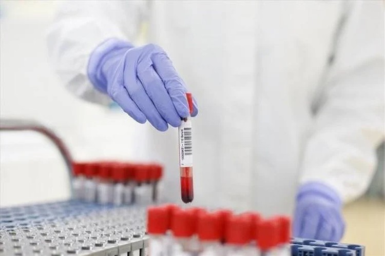 321 tỷ đồng mua sắm tập trung hóa chất, vật tư y tế năm 2025. Ảnh minh họa